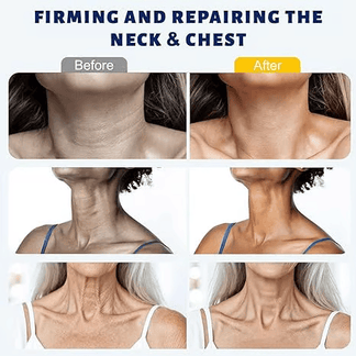 Ball Roller Tightening Neck Cream – Collagen Fullerene Firming Care for Neck & Jawline, Lightweight Hydrating Formula-HS