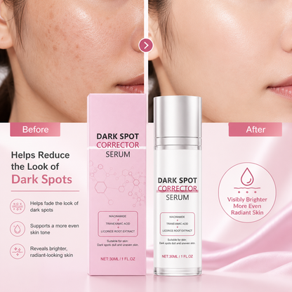 Dark Spot Corrector Serum – Niacinamide & Tranexamic Acid Face Serum for Brighter, More Even-Looking Skin